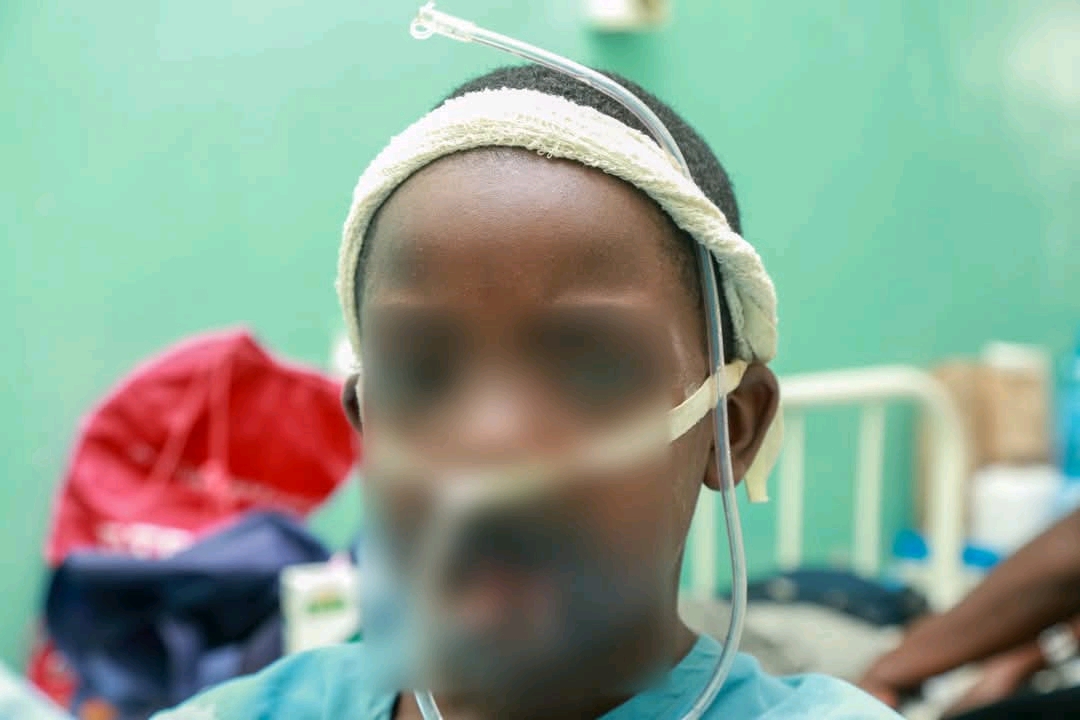 The 12-year-old boy after undergoing the complex surgery. He is recuperating at the facility awaiting further procedures. PHOTOS: CHRIS MAHANDARA