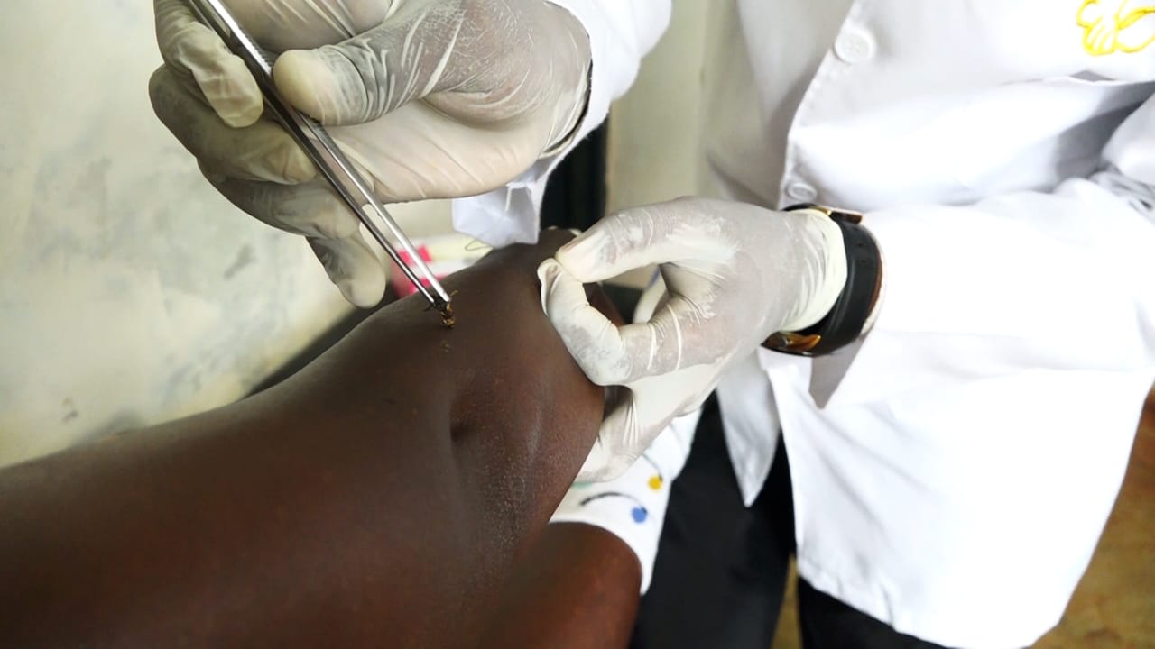 An apitherapist administering bee stings on a patient at an apitherapy centre in Kandara